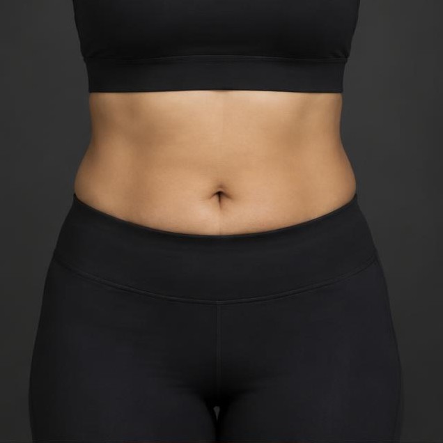 AI-generated illustration: Waist and abdominal contours; not a patient result